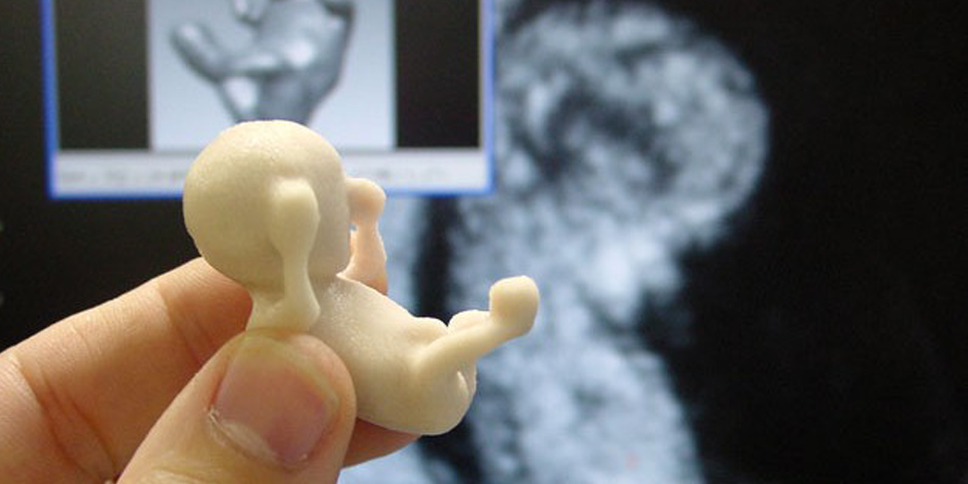 Abortion is Leading Cause of Death Worldwide for Fifth Straight Year