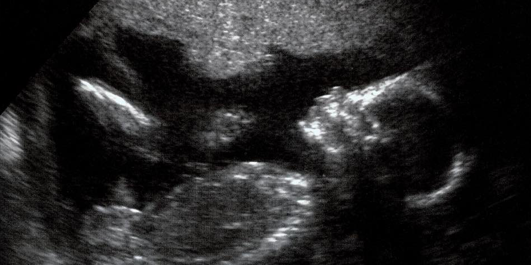 Abortion Amendment Backers Seek Signatures